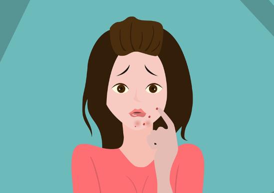 鼻子上长脓包痘多久会消?眉毛长痘痘怎么办?