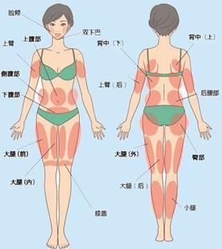 南京韩辰吸脂术 力求整形美无痕