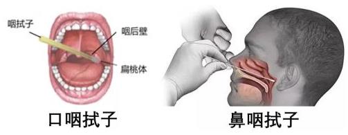 核酸检测阳性正常还是阴性正常