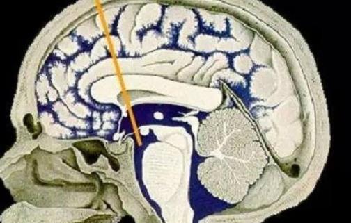 脑积水的治疗方式有哪些?脑积水治疗后需要补充哪些营养?