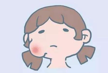 流行性腮腺炎的症状是什么
