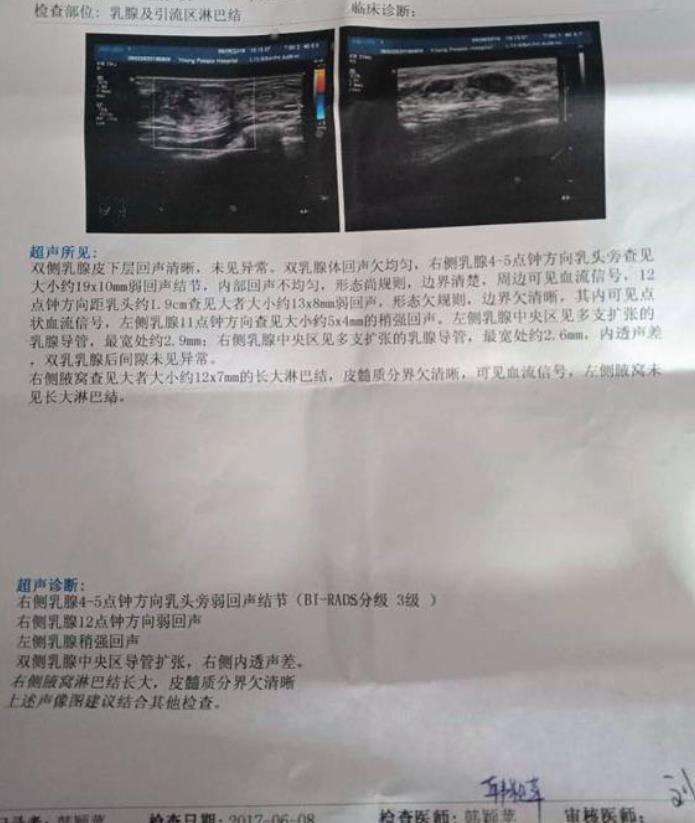 乳腺肿块应怎么治疗?康蓓诗乳康冷敷贴轻松康复不用愁