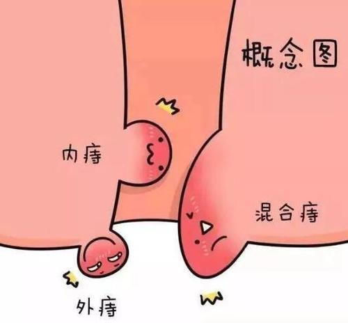 菊花长了个小肉球不痛不痒,这是怎么回事,不治会自己消失吗