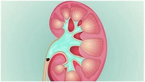 云南结石病医院肾结石患者:肾结石症状腰疼就像一把刀子来回绞动