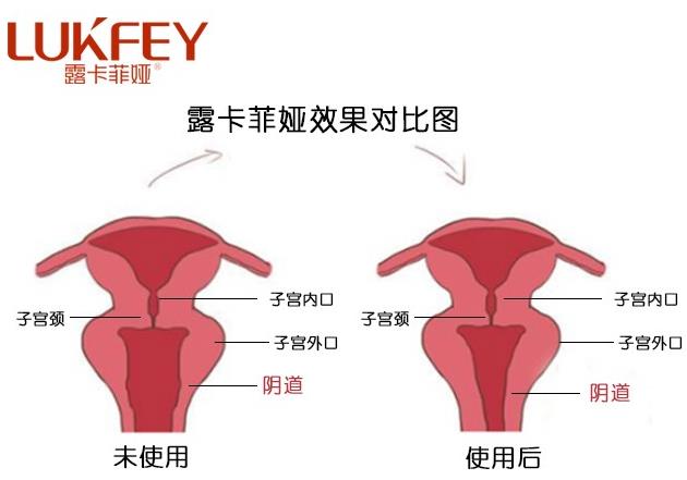 露卡菲娅药店有卖吗?露卡菲娅官方购买途径!