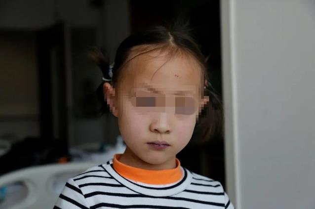 3年3次开胸,合肥京东方医院分期手术挽救先心女童性命