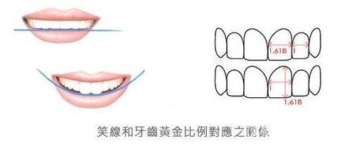 武汉仁爱口腔医师告诉你:牙齿矫正中不可忽视的微笑线!