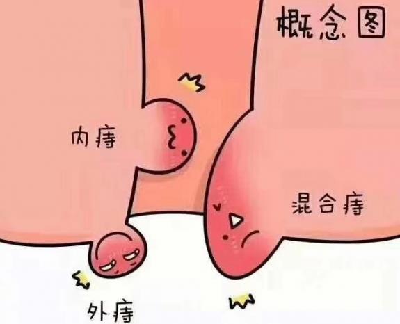 呼市东大肛肠医院收费贵吗