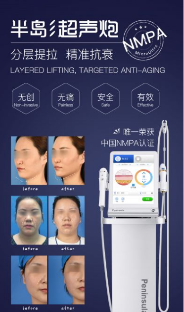 宁波艺星整形医院:7D黄金超声炮,深层抗衰,一次抵三次热玛吉!