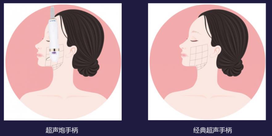 宁波艺星整形医院:7D黄金超声炮,深层抗衰,一次抵三次热玛吉!