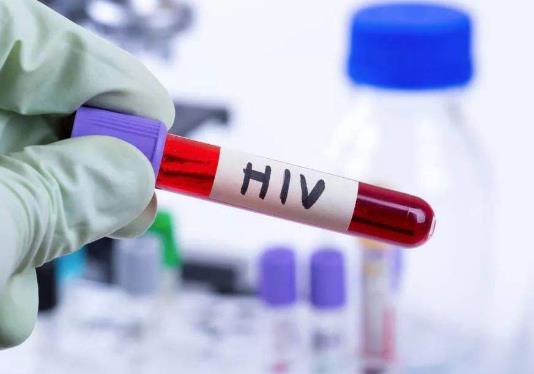 故意传播艾滋病需要负刑事责任吗?和hpv人接触会传染吗