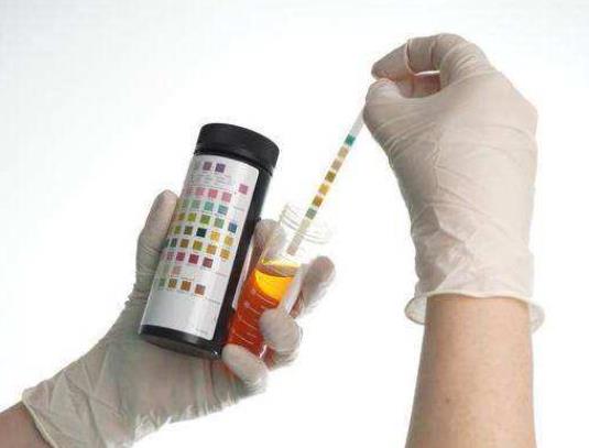 曾经尿酸高是不是一辈子都要注意?年轻人尿酸700多严重吗