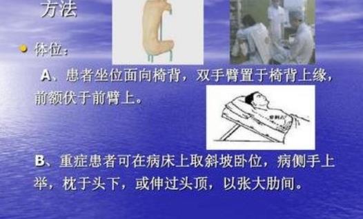 世界记载最早的腹腔穿刺 《黄帝内经》此书距今约1800年