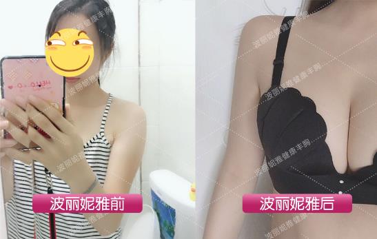 断奶后胸变小怎么办?辣妈必知的产后高效丰胸法!