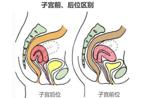 子宫前位容易怀孕吗 子宫前位和子宫后位的区别
