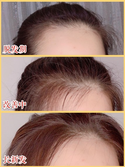 哪种洗发水好 学戚薇任性扎丸子头少不了滋源