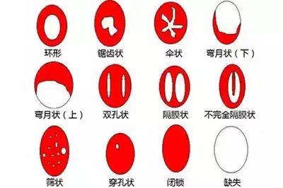 女性阴部真实照片：详解健康女人真实完美阴道图片【多图】(图4)