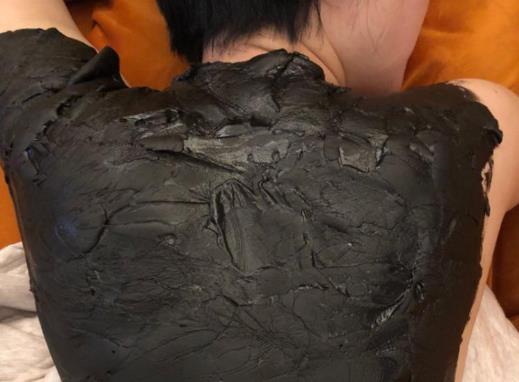湿气重的人能天天敷泥灸吗?泥灸排出拉丝的透明液体是什么
