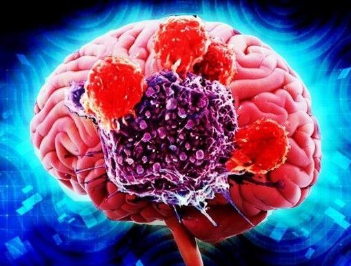 世界十大痛苦癌症排行,胃癌发病率高,肺癌死亡率最快