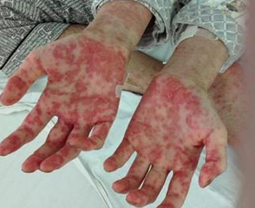 世界十大痛苦癌症排行,胃癌发病率高,肺癌死亡率最快
