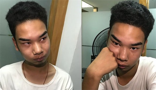 发际线男孩是什么意思什么梗 发际线男孩是谁