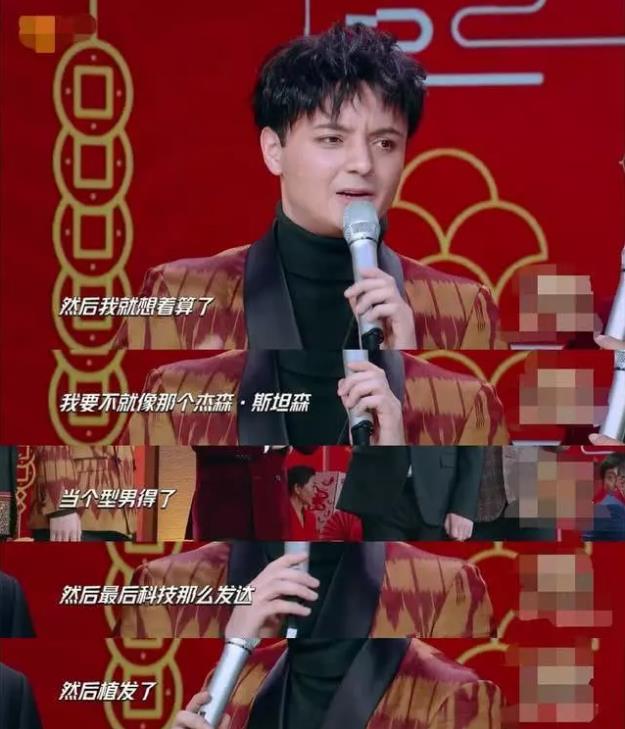 秃然长大是什么意思?童星阿尔法19岁谢顶21岁植发成功分享经历