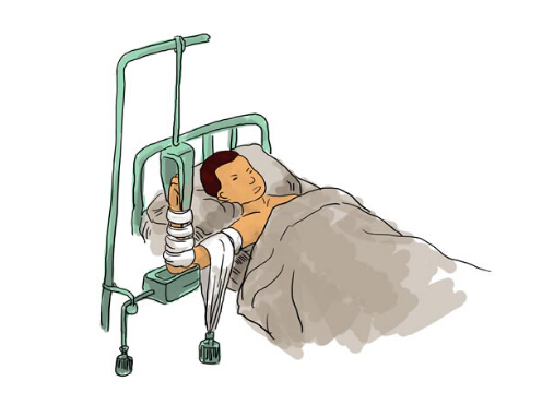 骨折病人吃什么好?骨折愈合的时间