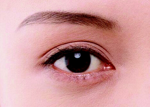 怎样让眼睛自然变大?什么是小眼症矫正