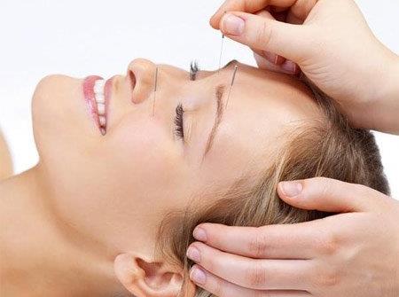 针灸美容效果好吗?针灸美容的功效