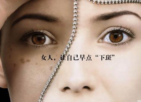 经期延长引发黄褐斑怎么办?如何预防黄褐斑