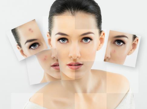 美白祛斑误区:爱美女性须知的美白祛斑四个误区