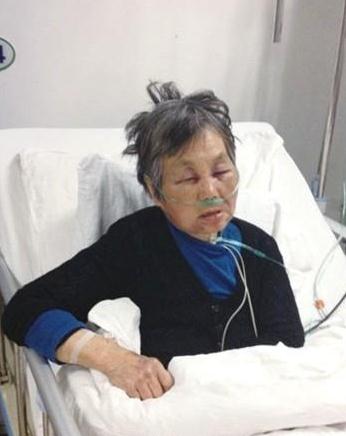 教授醉酒耍酒疯残忍殴打7旬老人令人发指，被打老人昏迷大小便失禁