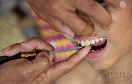 印尼巴厘岛怪异“成年礼”习俗，少男少女参加锉牙齿仪式避邪