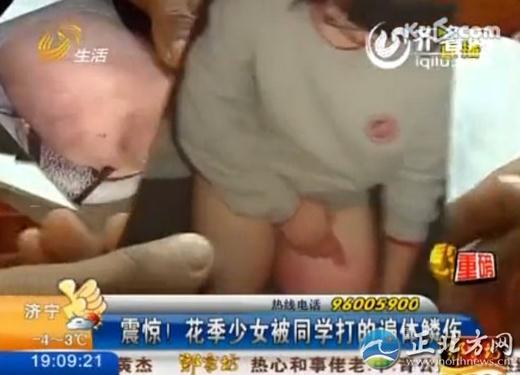 16岁花季少女被四名室友殴打4小时，脱光了跪在地上打，打得遍体鳞伤