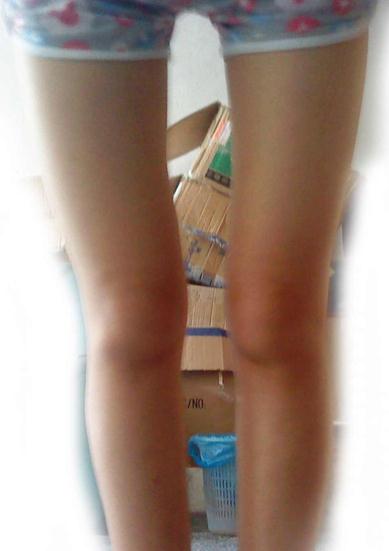 科普！有些大腿之间缝隙超大的女人完全是天生，与做那事OOXX无关(图)