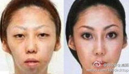 【老婆太丑】老婆漂亮女儿太丑,男子告整容老婆获赔75万,是整容医院炒作吗