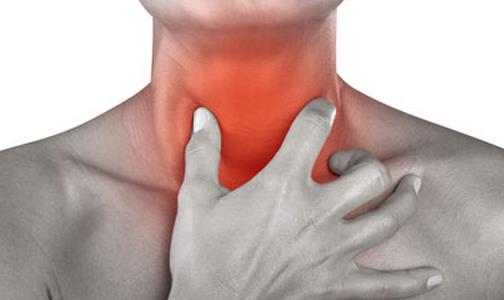 喉癌的早期症状 预防喉癌刻不容缓