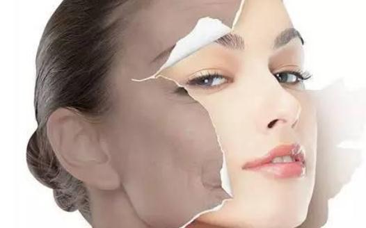 怎么才能祛斑？为什么会长斑？