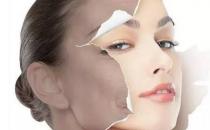 怎么才能祛斑？为什么会长斑？