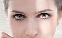 开眼角手术要注意六件事