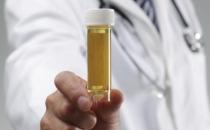 从尿液看健康 健康尿液的6大黄金标准
