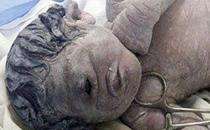 ​埃及孕妇遭辐射 产下独眼男婴
