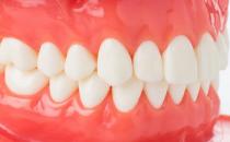 哪种材料的假牙适宜老人用?