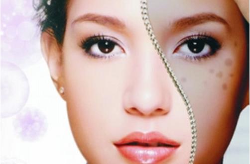 好习惯能帮忙扫除色斑