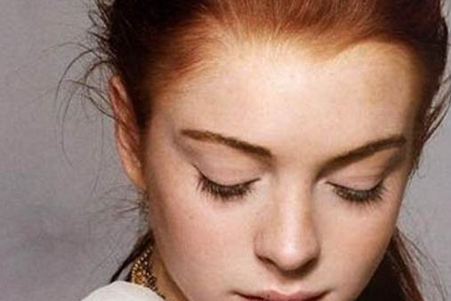 祛斑失败的原因有哪些 如何应对