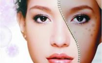 好习惯能帮忙扫除色斑