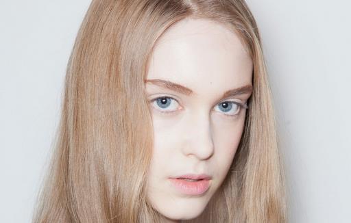 女生头皮屑多又痒怎么办