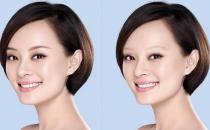 眉毛种植的适用人群有哪些