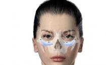 为您介绍下颧骨填充材料的种类