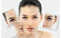 哪种手段治疗痘坑更有效呢？